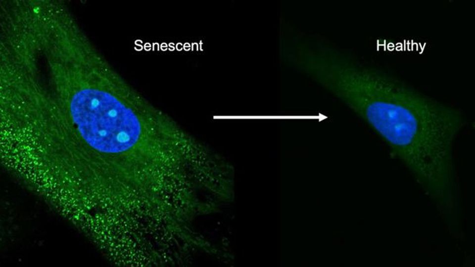 The Villain of Skin Aging: How Cell Senescence Wreaks Havoc on Your Youthful Glows